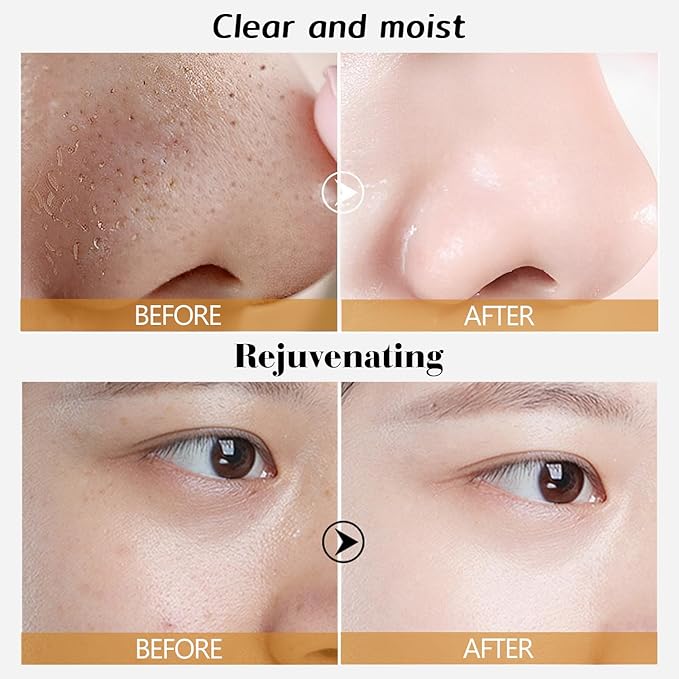 🔥 Gold Peel-Off Face Mask – Buy 1 Get 1 FREE! Limited Stock – Anti-Aging & Blackhead Removal Must-Have!