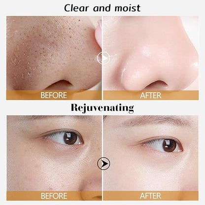 🔥 Gold Peel-Off Face Mask – Buy 1 Get 1 FREE! Limited Stock – Anti-Aging & Blackhead Removal Must-Have!